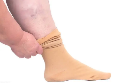 静脉曲张袜长度到脚踝可以吗,静脉曲张袜长度怎么选择的